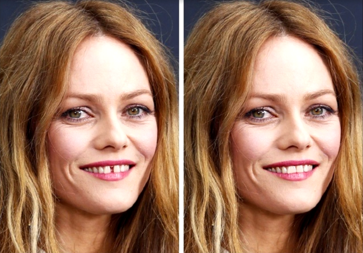 Как выглядят некоторые. Vanessa paradis зубы. Ванесса Паради улыбка. Ванесса Паради Щербинка. Ванесса Паради в молодости