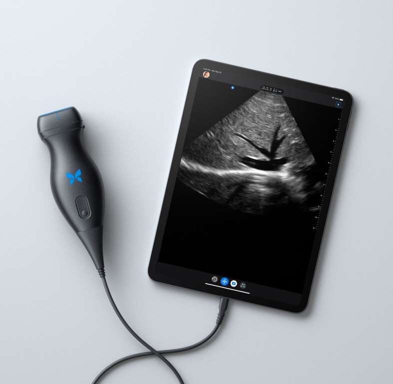 Многоцелевой портативный УЗИ Butterfly iQ можно приобрести в Европе