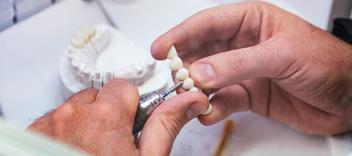 Изготовление коронок на зубы