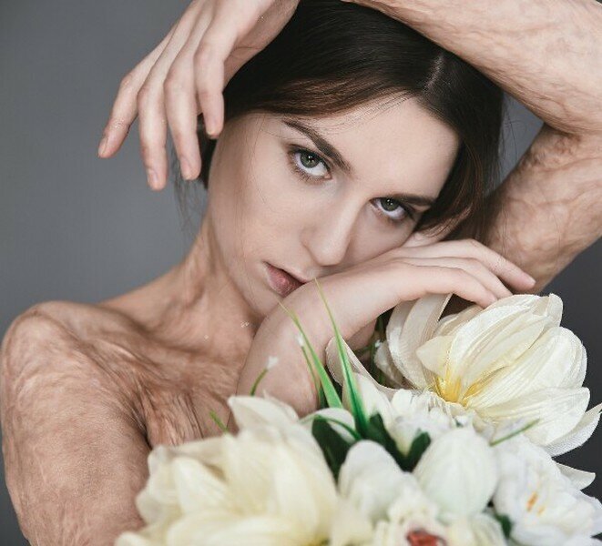 Света "Уголек" Алексеева