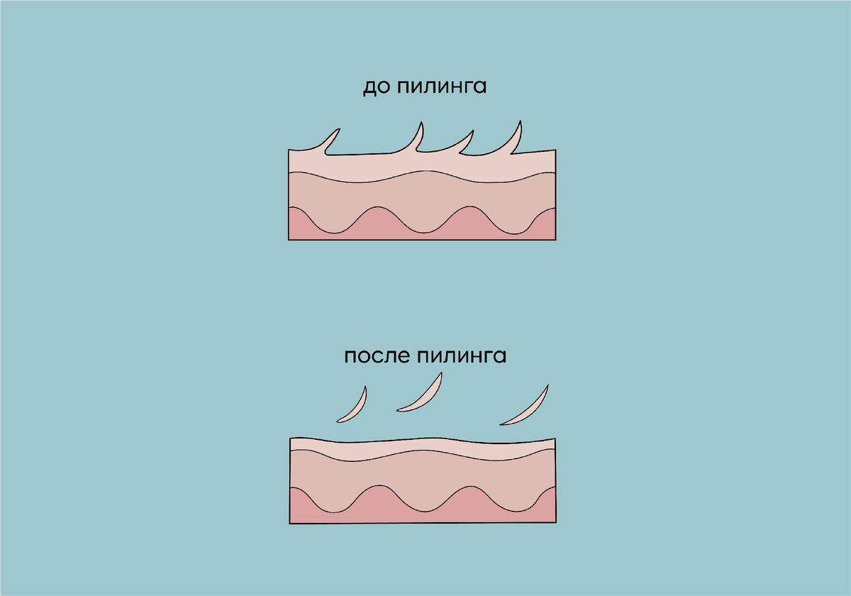 Как работает пилинг. Как работает пилинг