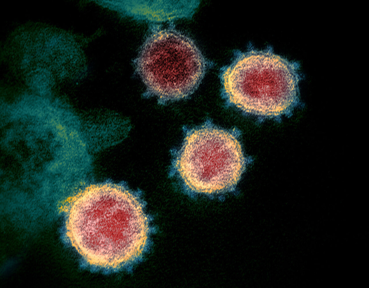 Coronavirus под микроскопом.