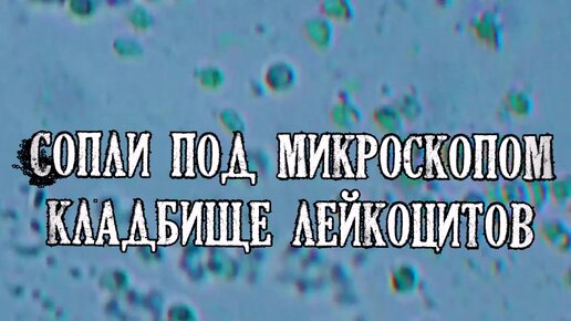 Сопли под микроскопом для детей The horror under the microscope Insolite, Le monde, Insectes