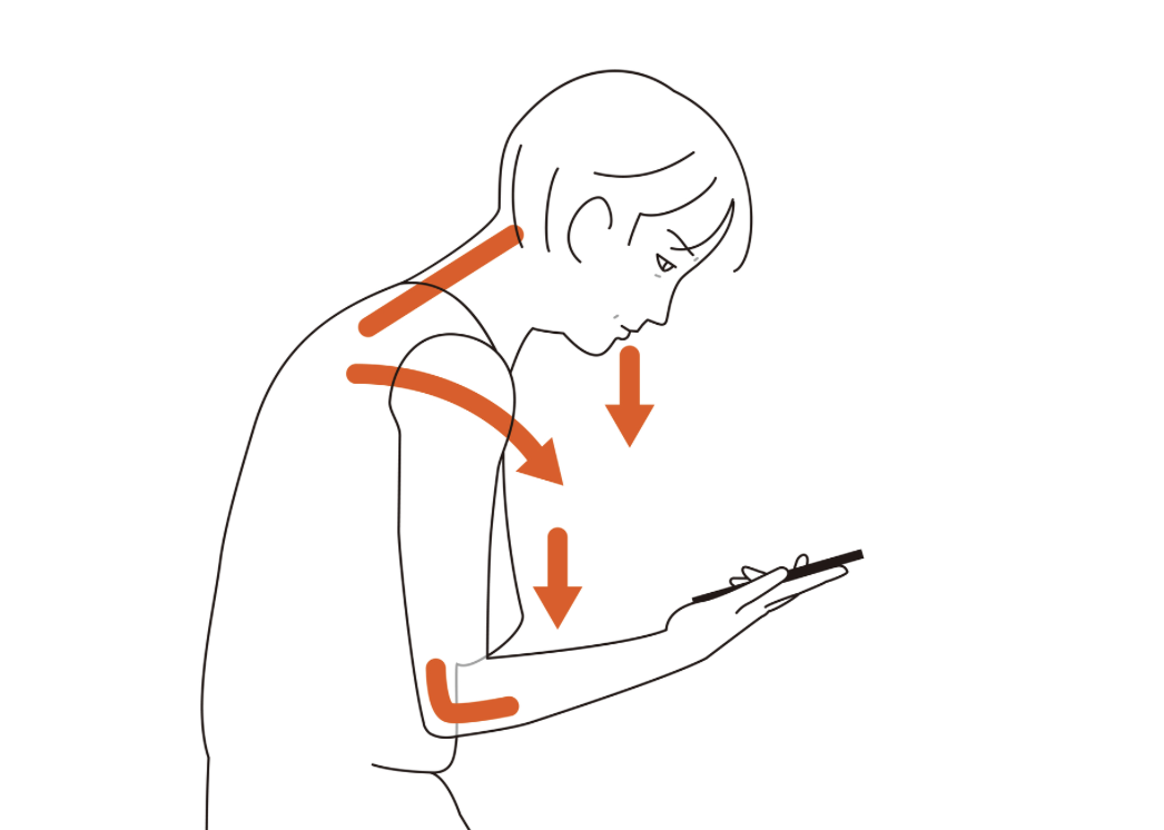 Заворачивание плечей, изменение положения шеи при взгляде в телефон 