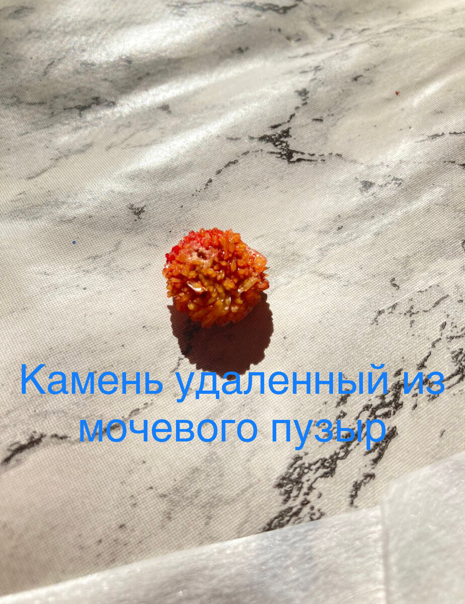 Добавьте описание