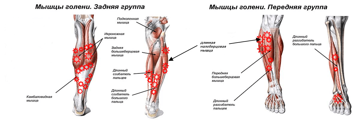 Камбаловидная мышца мышцы голени