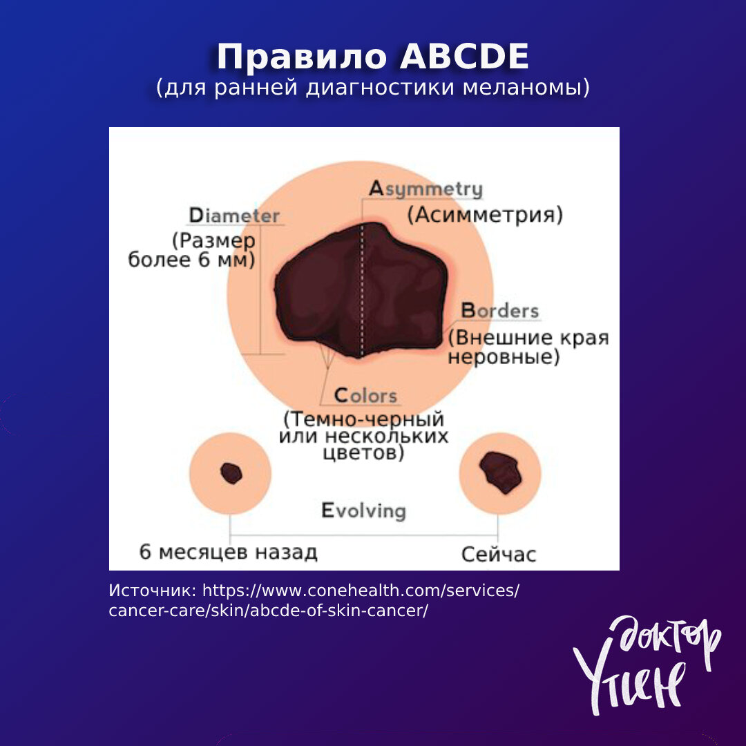 Правило ABCDE для ранней диагностики меланомы