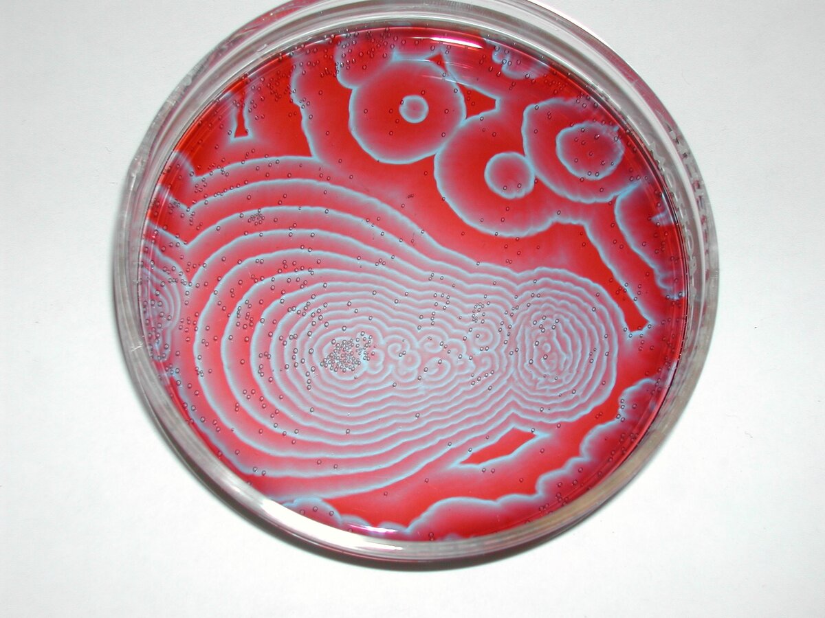 Реакция Белоусова-Жаботинского