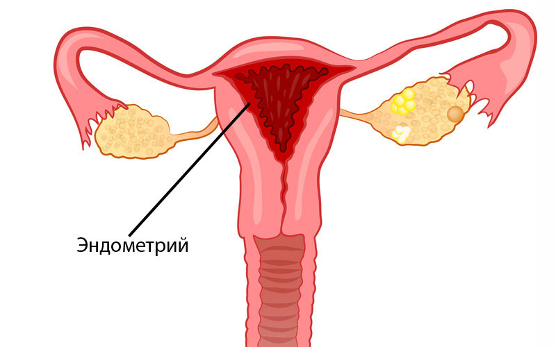 Статьи о заболеваниях