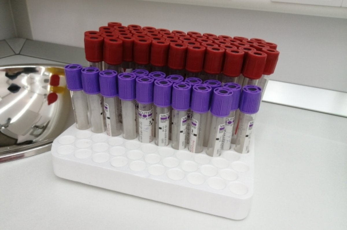    В Томске смогут диагностировать рак мозга по анализу крови