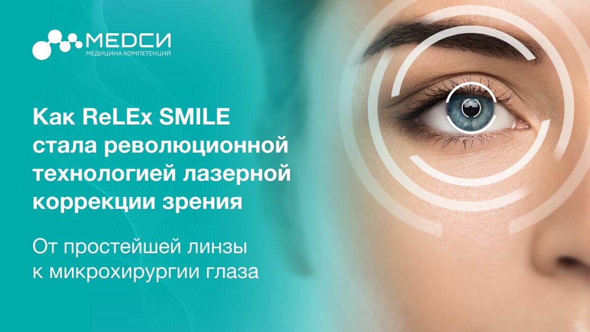 Презентация на тему лазерная коррекция зрения