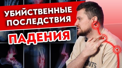 У моего продюсера ОТСТЕГНУЛАСЬ рука! Как лечить защемление локтевого нерва?