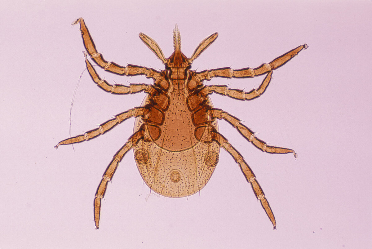Источник: https://www.prevention.com/health/a20117220/tick-borne-diseases/ 
