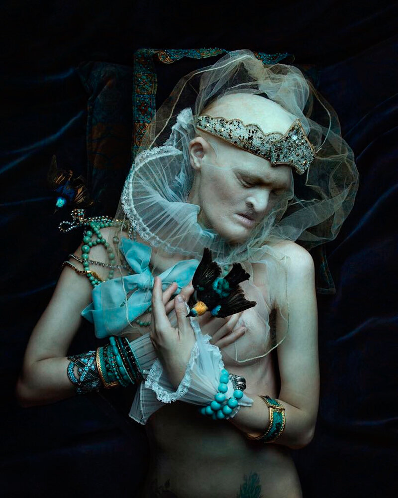 Это генетическое заболевание называется эктодермальная дисплазия. Волосы растут вовнутрь, а врастающие реснички повредили роговицу глаз, из-за этого Мелани частично потеряла зрение. 8 месяцев пыталась приспособиться к вставной челюсти, но это приносило мучения и неудобство. Перенесённые в детстве 40  операций подкорректировали форму ушей, глаз, рта.