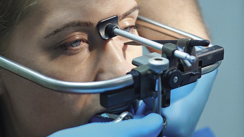 установка лицевой дуги