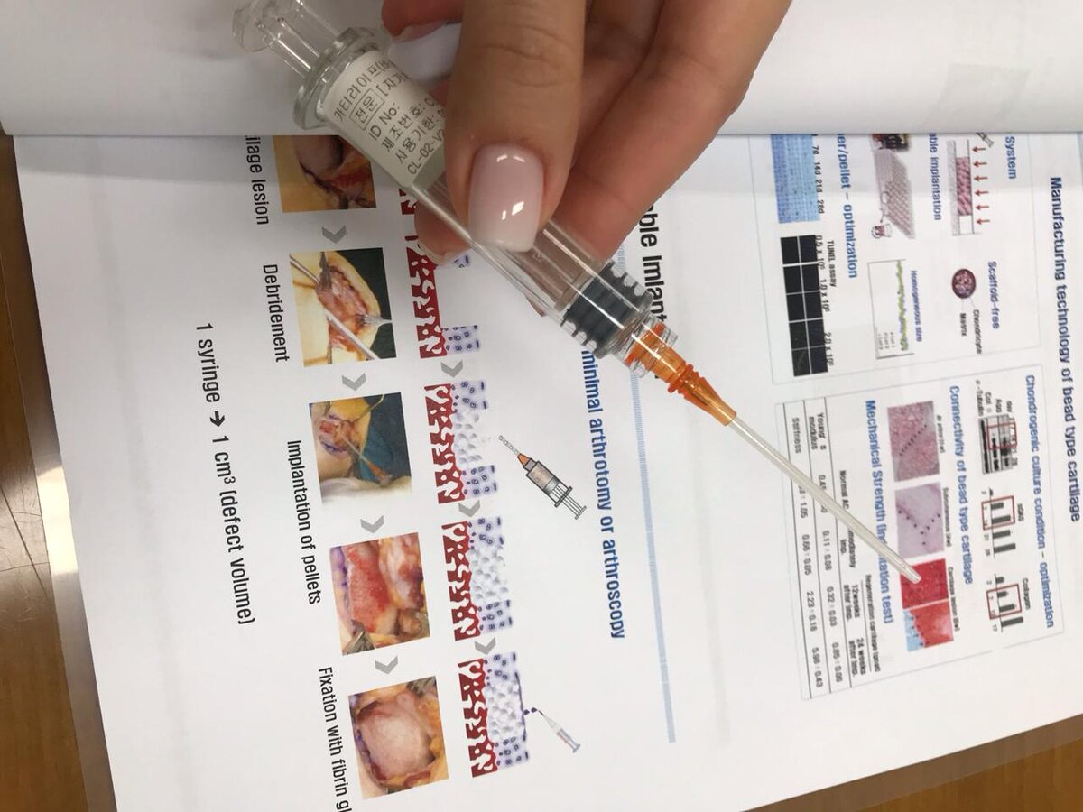 Через такой шприц вводится уже готовые гранулы хряща в коленный сустав