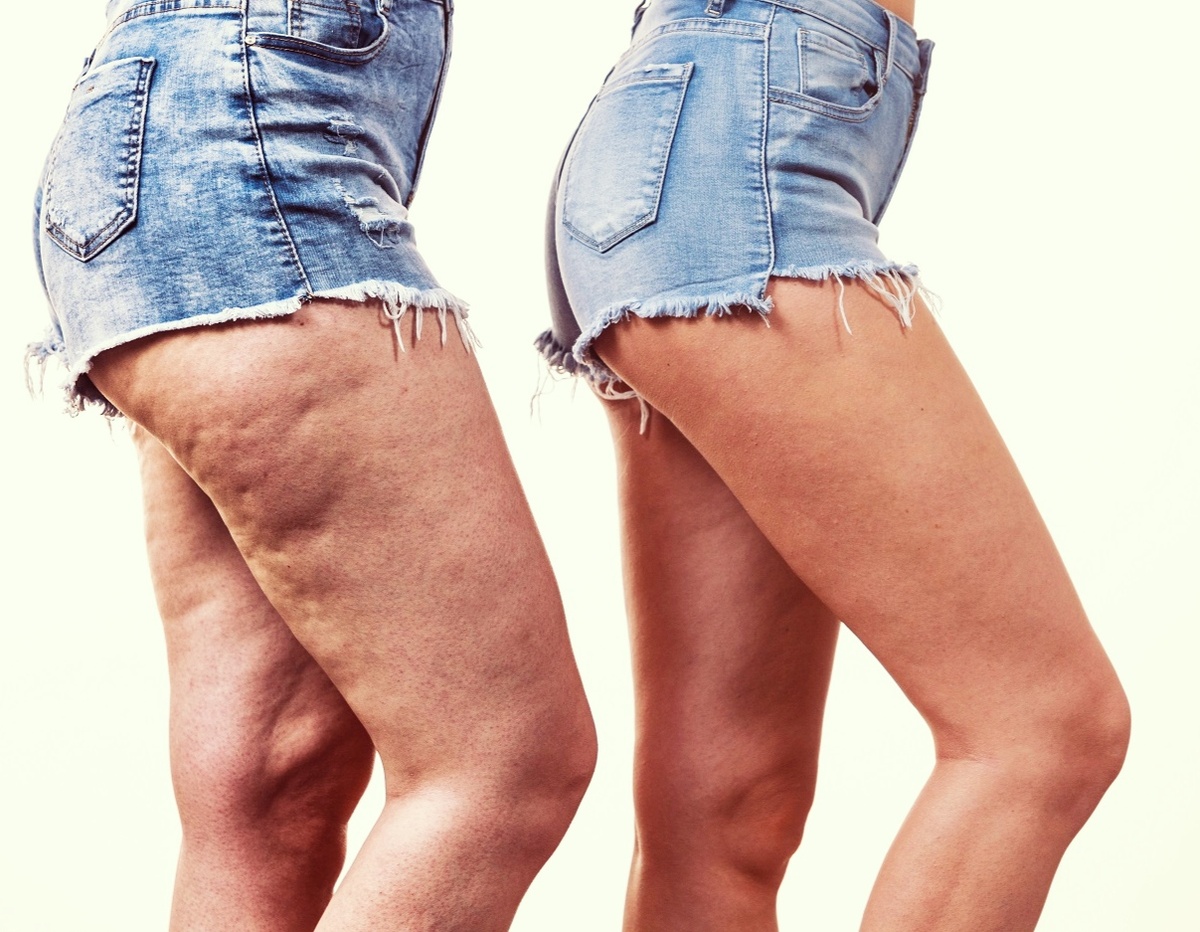 Изображение взято на просторах интернета.