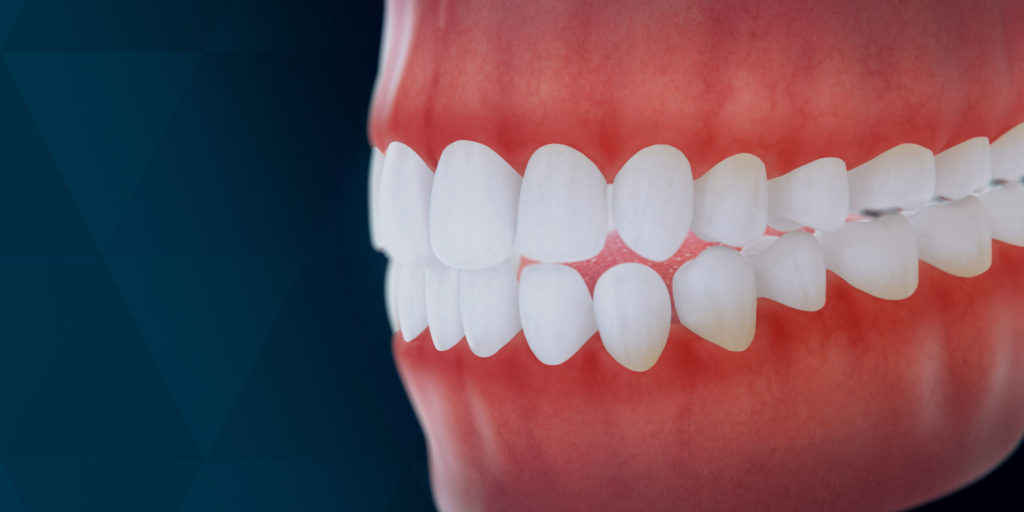 Улыбка с зубами. Красивая улыбка ровные зубы. Здоровье десен. Красивые зубы. Здоровье десен.
