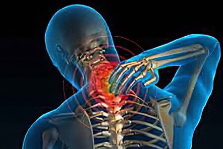 Лечение остеохондроза шейного отдела позвоночника — Симптомы