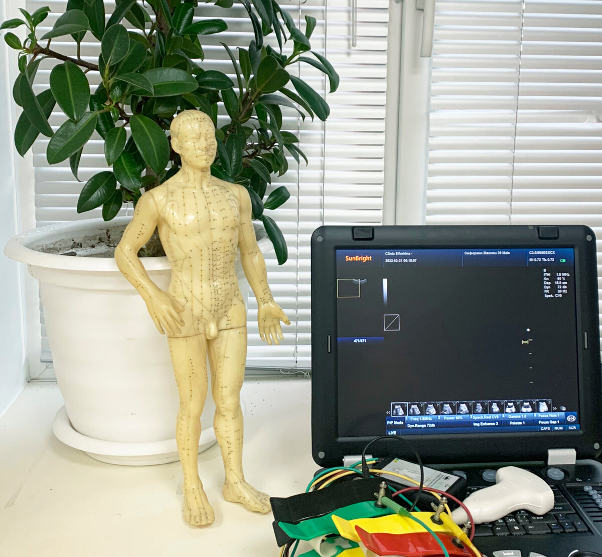 На картинке макет человеческого тела с меридианами и точками, аппарат УЗИ и скрининг-система сердца "Кардиовизор"