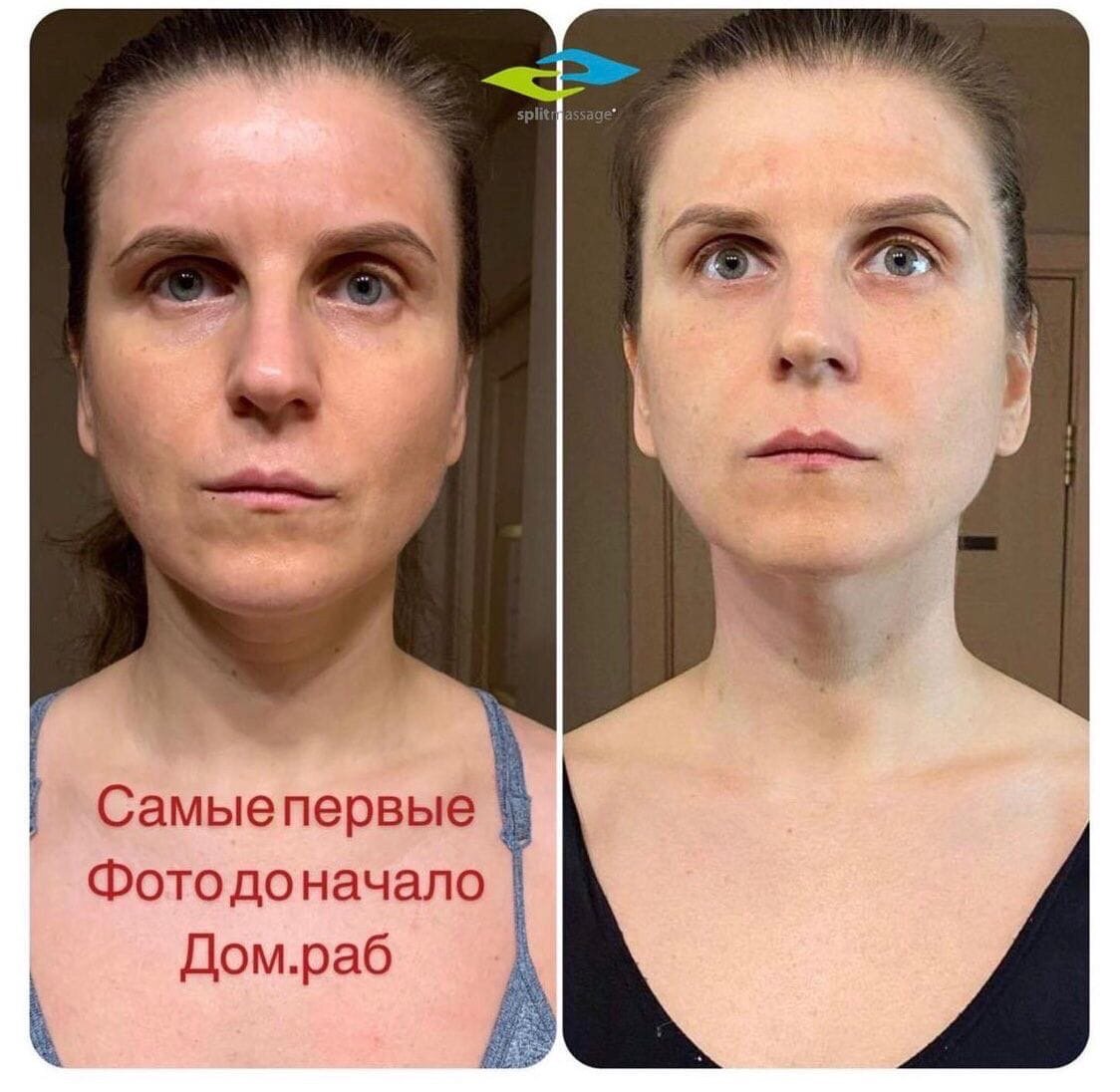 Институт Сплитмассаж 