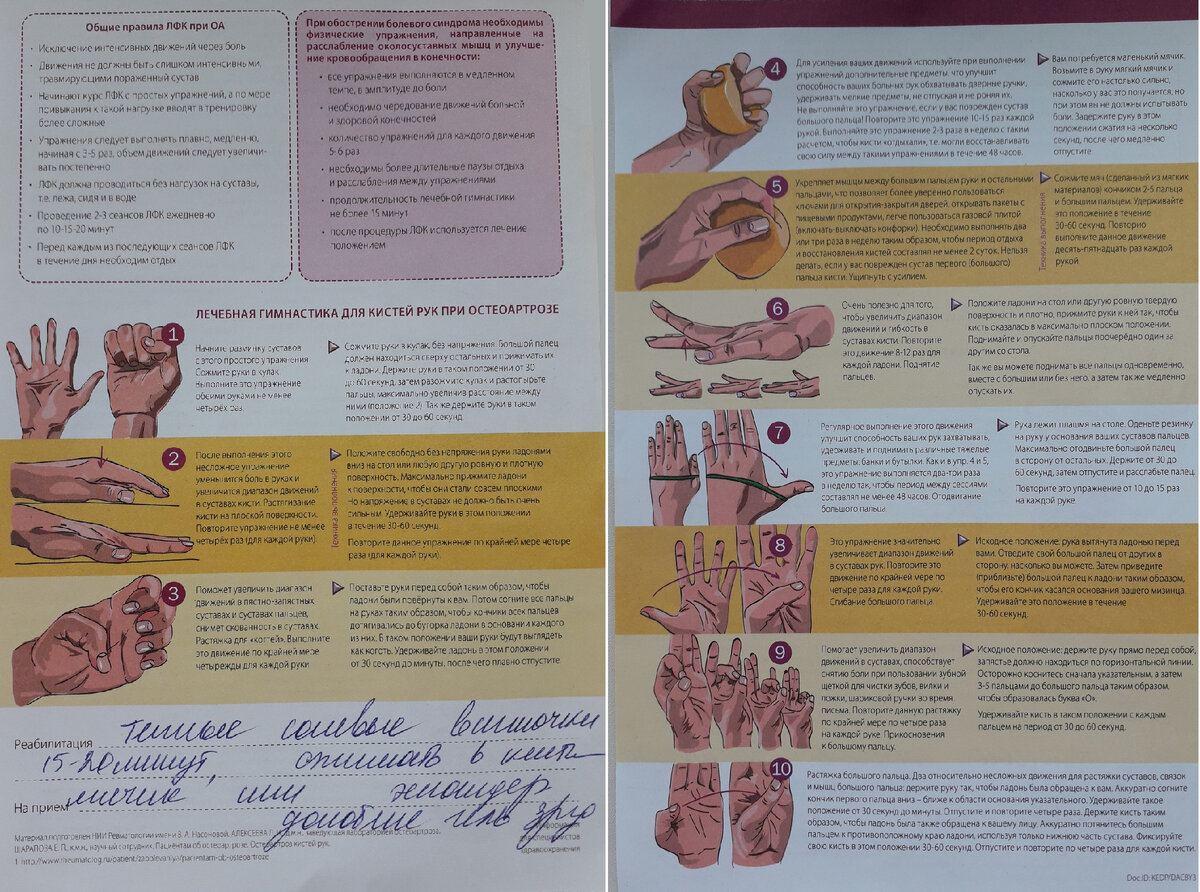 Памятка при артрозе