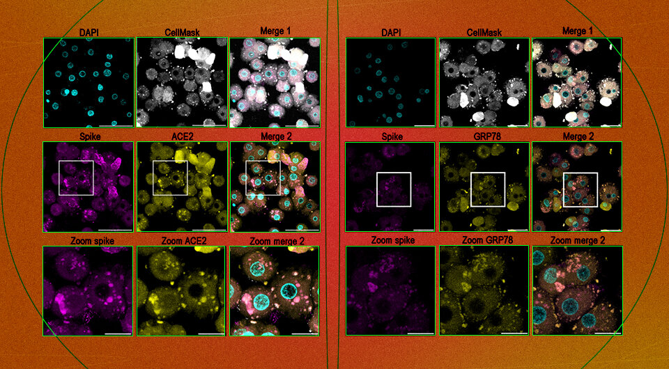     Рецепторы ACE2 и GRP78 на гепатоцитах колокализованы со спайк-белком коронавируса спустя 50 минут после инфицирования Ester A. Barreto et al. / PNAS, 2023; N + 1