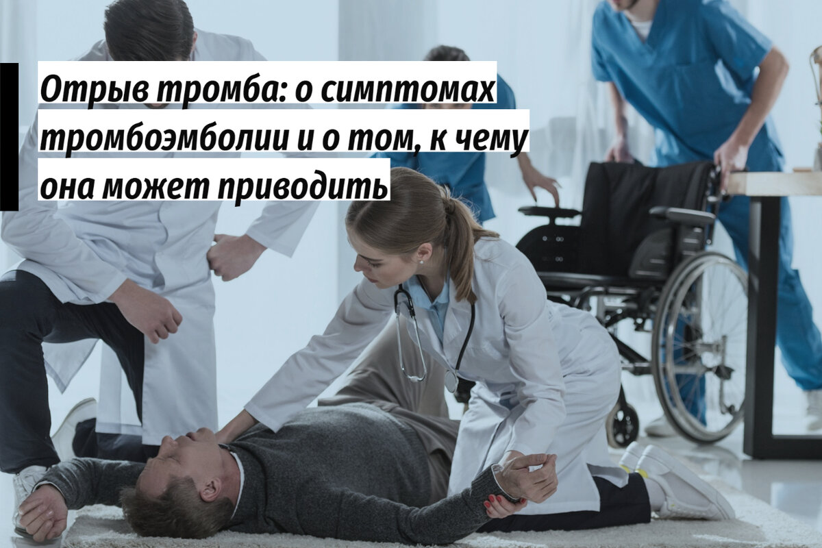 Оторвался тромб: что может на это указывать и к чему это приводит
