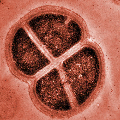 Так выглядит тетрада клеток Deinococcus radiodurans.