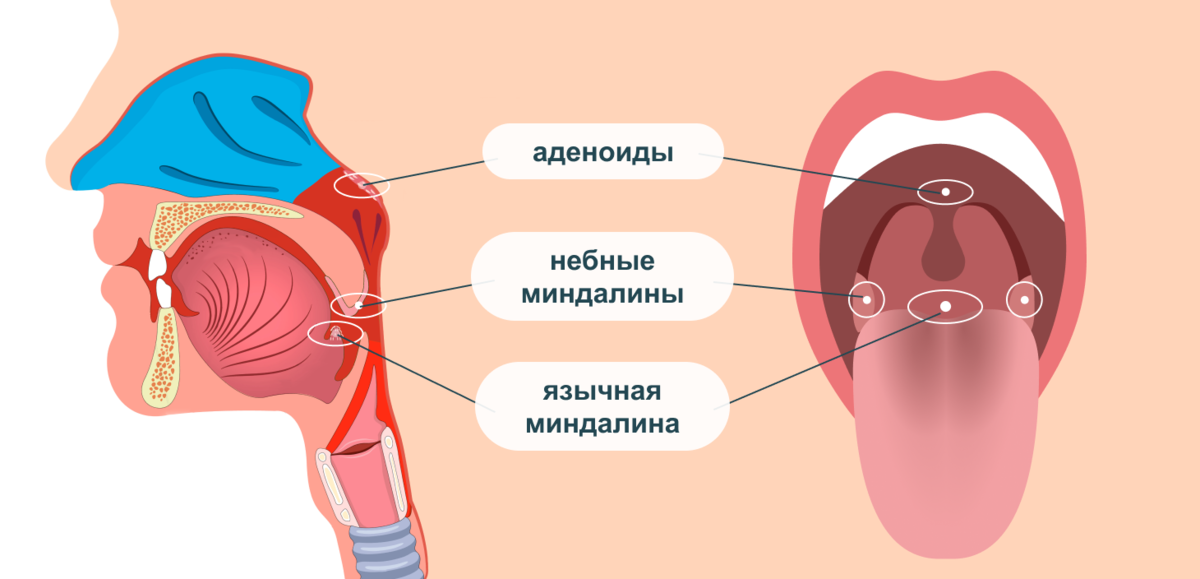 Что такое аденоид. Анатомия ЛОР органов аденоиды. Строение горла аденоиды. Миндалины аденоиды анатомия. Язычная миндалина анатомия.