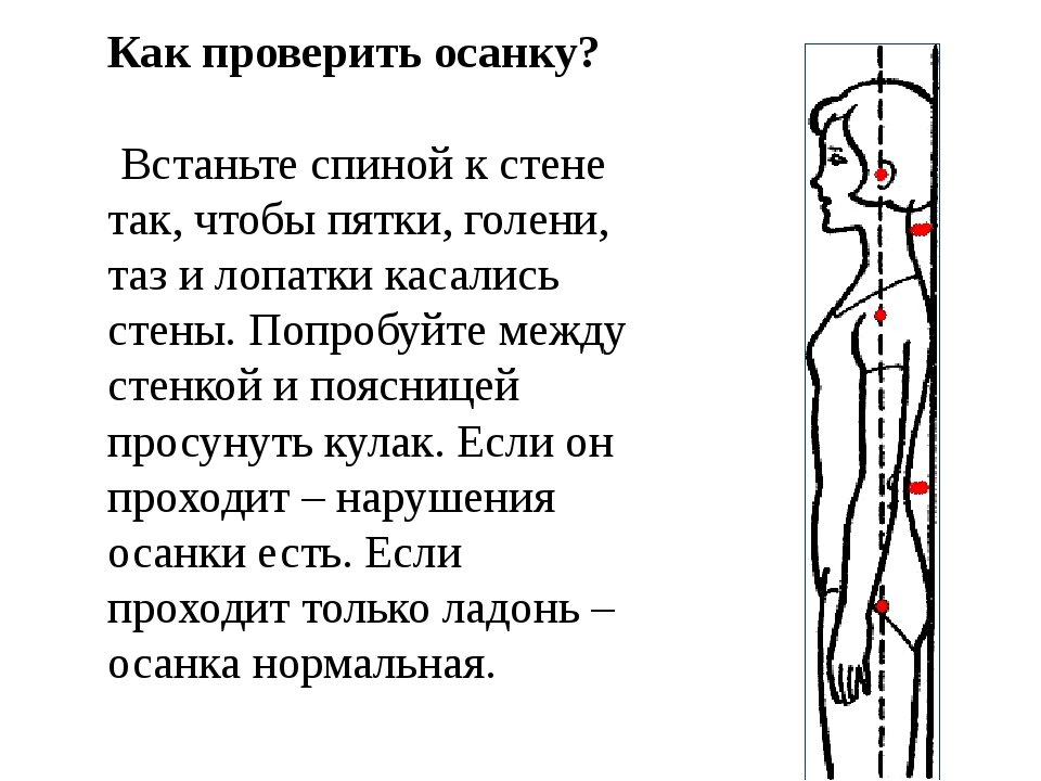 Тестовая карта для выявления нарушений осанки