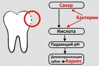 https://nurimed.ru/vliyanie-sahara-na-zuby/