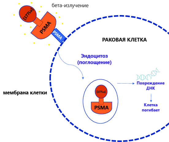 Стадии рака простаты, лечение 3 и 4 стадии. Прогнозы