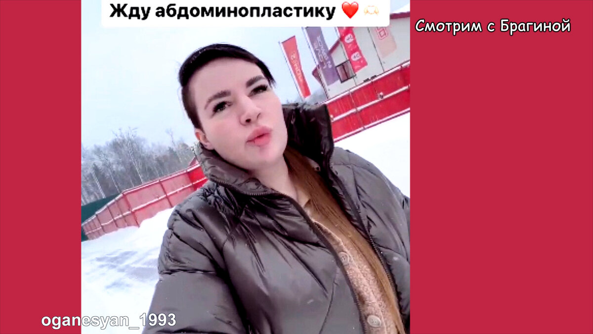 Черно перед операцией, инстаграм