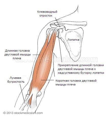 Порванный бицепс - 60 фото