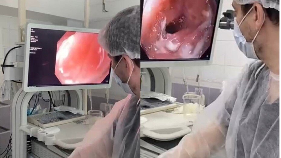    Врач петербургского Детского городского многопрофильного клинического специализированного центра высоких медицинских технологий во время операции Автор фото: Пресс-служба комитета по здравоохранению Петербурга