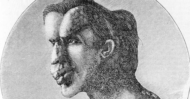 Голова человека-слона.