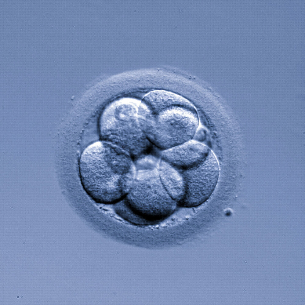 institutobernabeu.com