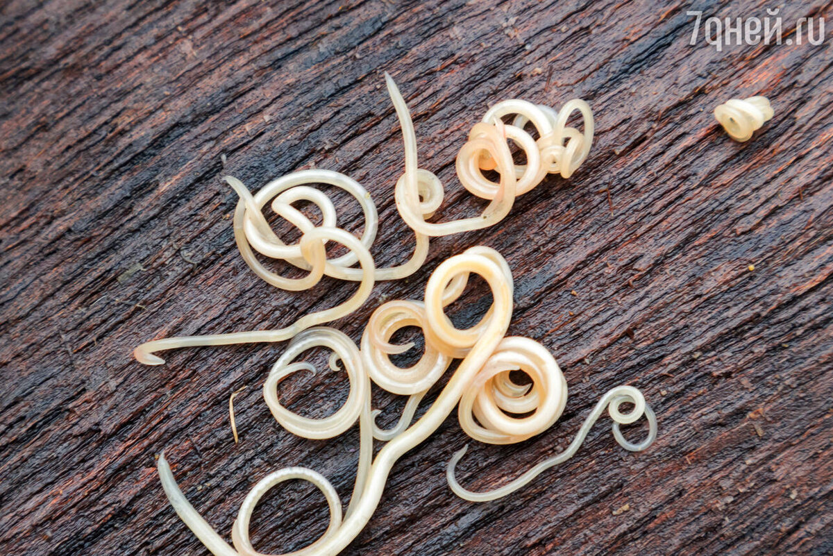    К чему снятся глисты 123RF/legion-media.ru