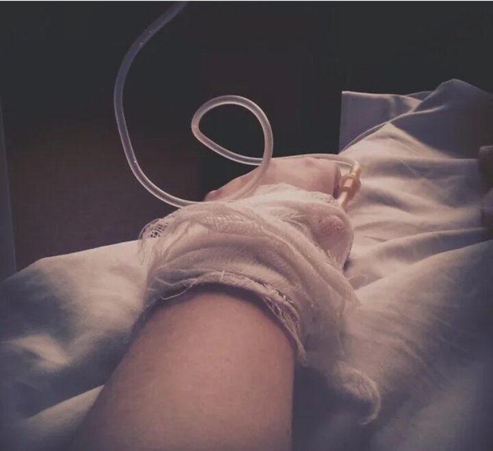 Фото ноги в больнице на кровати