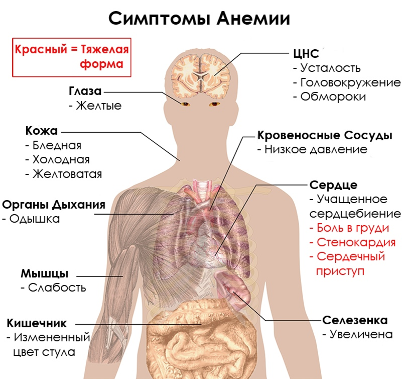 Цвет стула при анемии