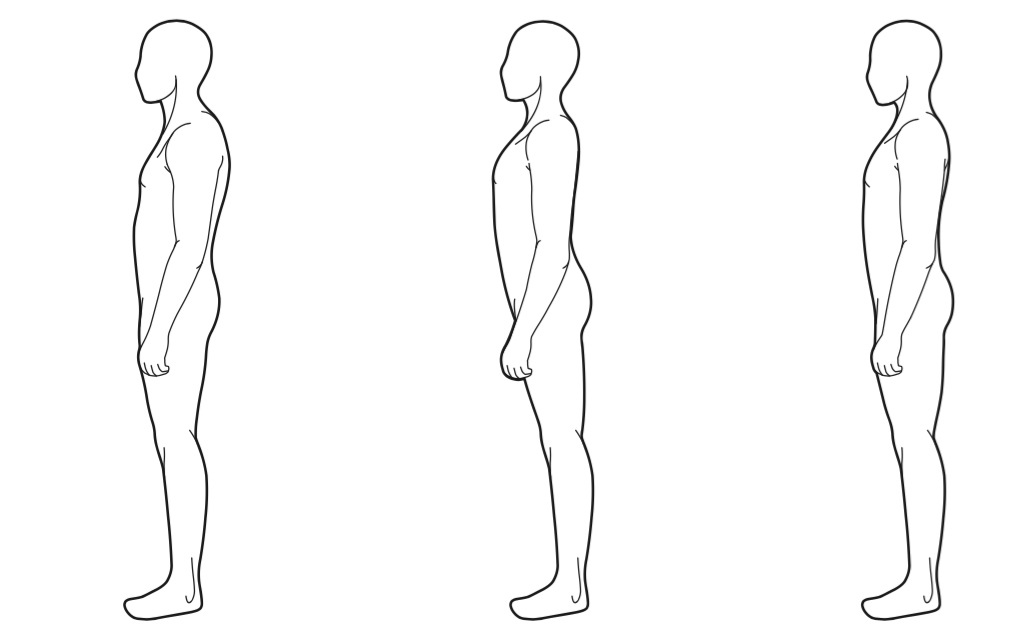 1. Наклон таза вперёд; 2. Наклон таза назад; 3. Нормальная осанка.