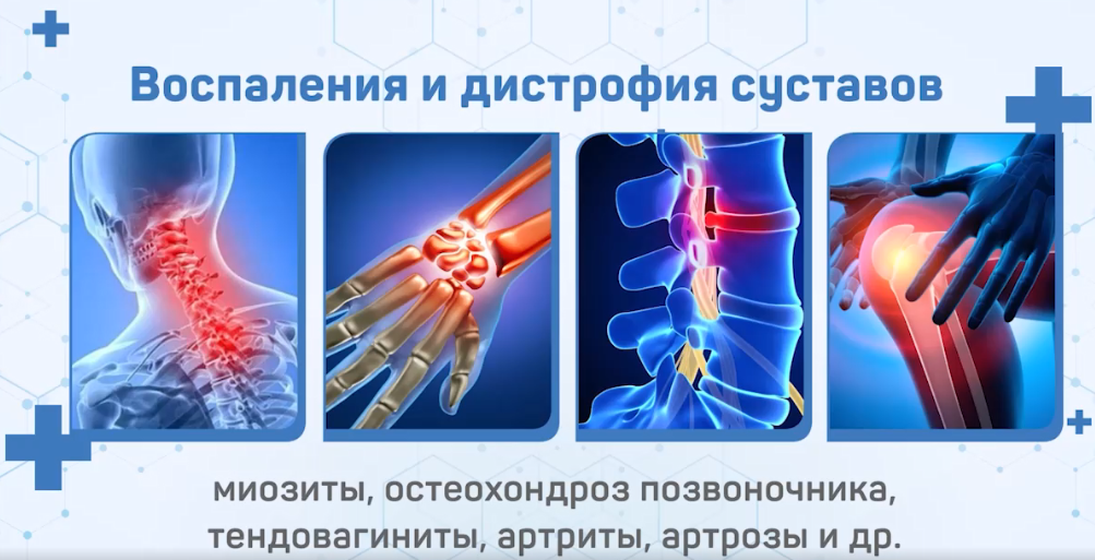 От чего помогает Артротин