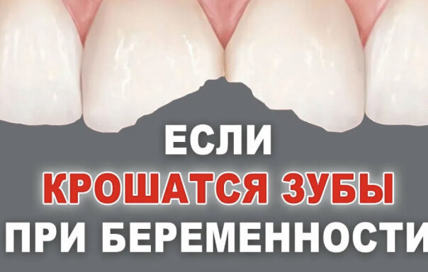 Стоматология для беременных