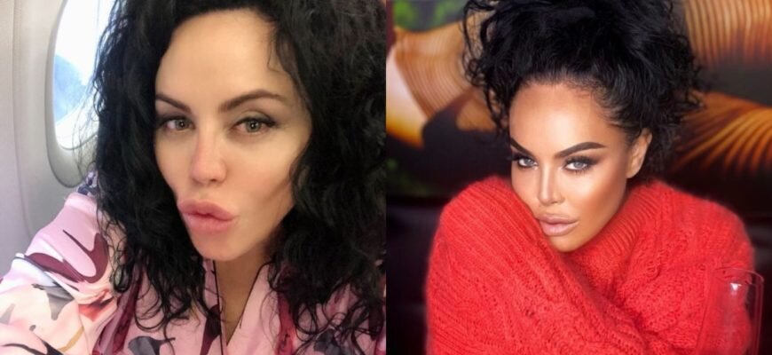 Байрак оксана до и после пластики Потрясающая фраза А.Балабанова, которая поможет женщинам избавиться от желания м