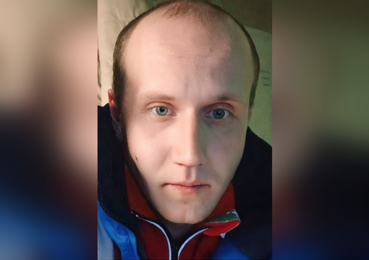    В Тверской области разыскивают мужчину с родинкой на правой щеке