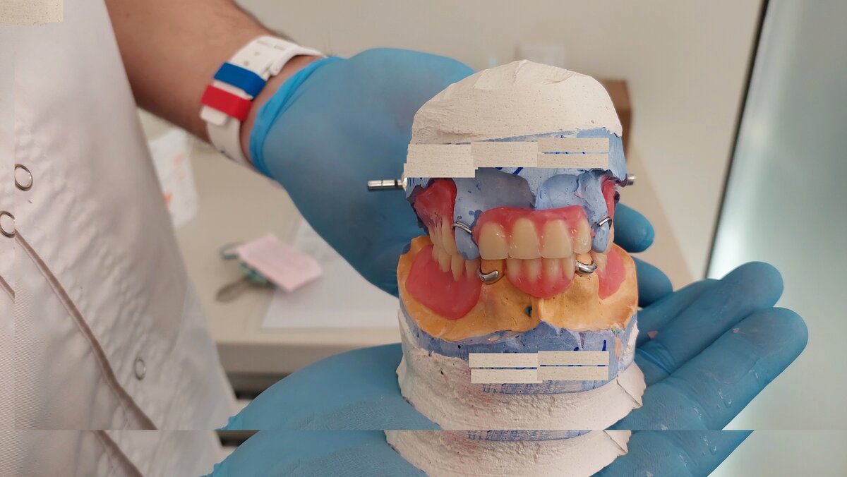 Вот они зубки мои.