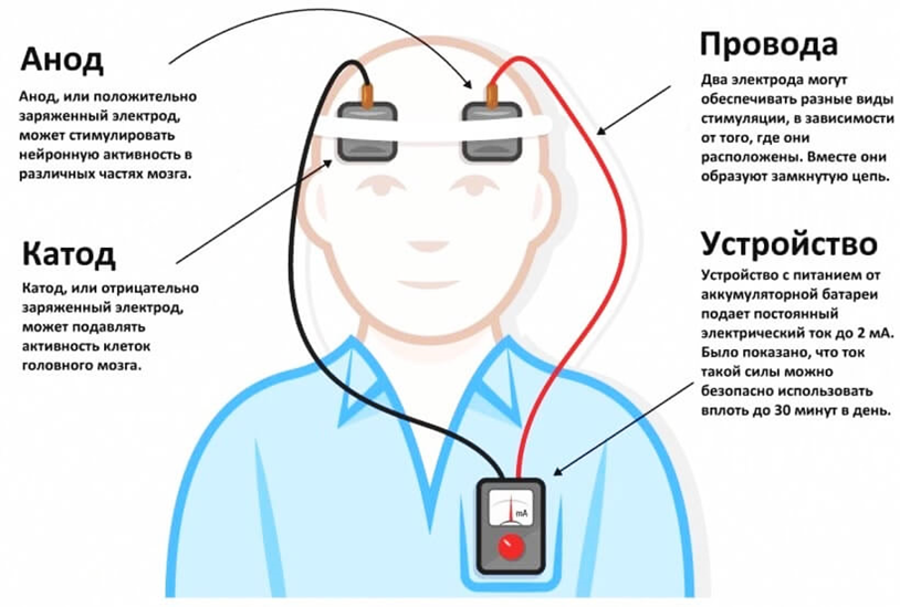 Стимуляция мозга. Аппарат транскраниальной электростимуляции головного мозга. Транскраниальная стимуляция головного мозга постоянным током. Транскраниальная электростимуляция (ТЭС) головного мозга. Транскраниальная магнитная стимуляция\ схема.
