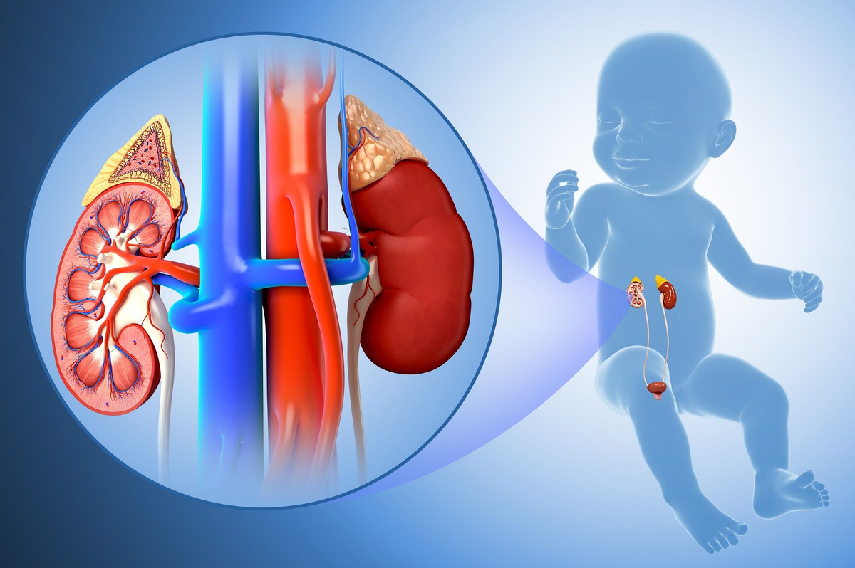 агенезия почки односторонняя. сколько можно прожить с одной почкой женщине. одна почка у ребенка с рождения. ребенок родился с одной почкой. ребенок родившийся на 22 неделе.