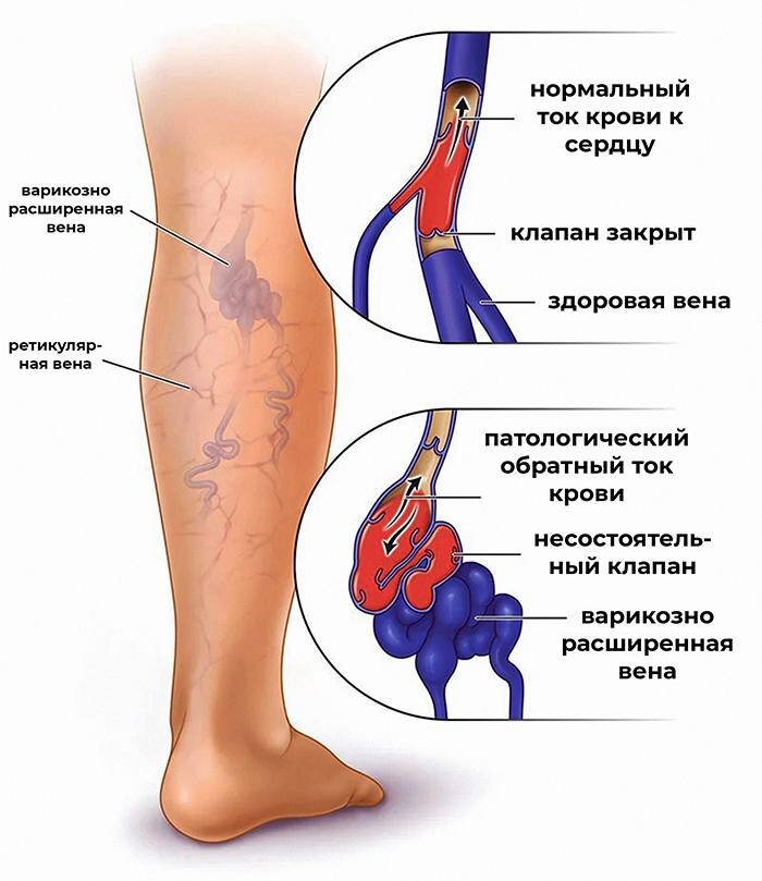 Пигментация кожи: чем опасно и как лечить